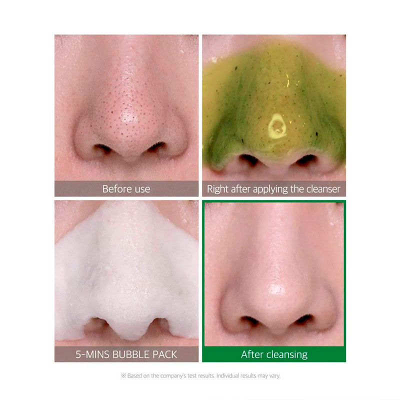 SOME BY MI Bye Bye Blackhead Bubble Cleanser Korean pore-refining treatment