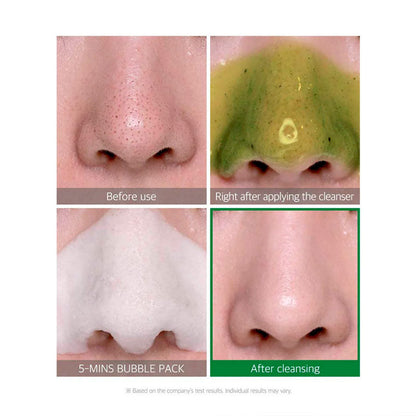 SOME BY MI Bye Bye Blackhead Bubble Cleanser Korean pore-refining treatment
